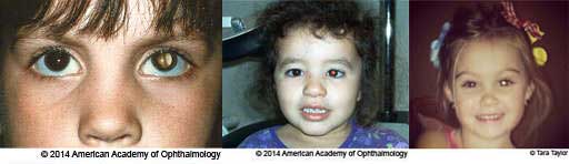 .Laser Eye Surgery Operations.